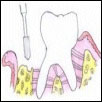 The bone is contoured
